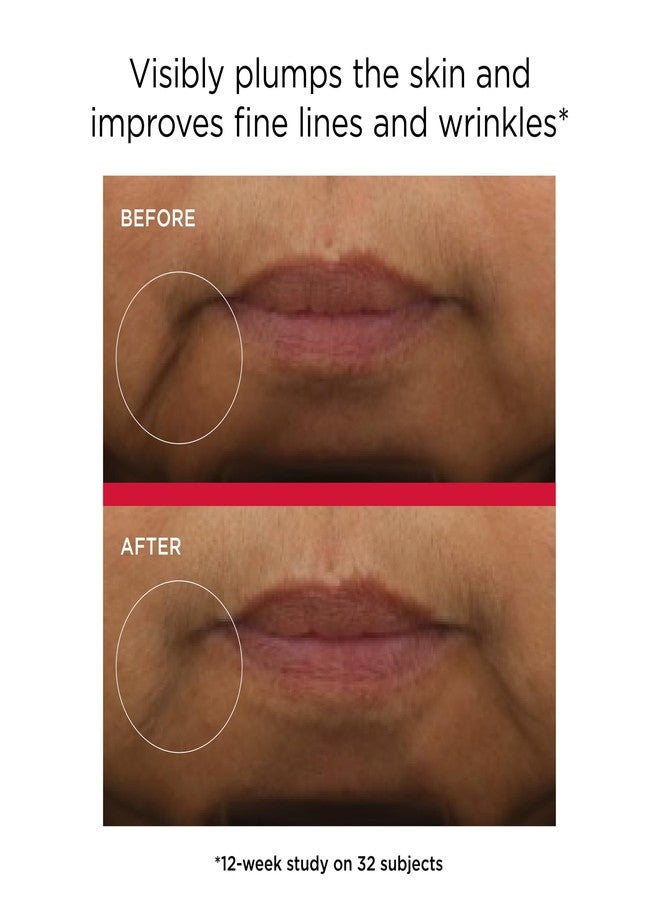 ايتا ام دي EltaMD UV Daily Hydration+ SPF 50، واقي شمسي هجين خفيف الوزن موثوق به من قبل أطباء الجلد، يوفر حماية متقدمة من الشمس وترطيبًا تصحيحيًا للبشرة. - Image 2